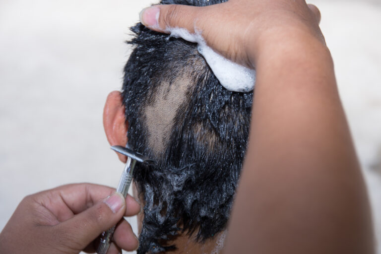 Psychologists Weigh In: Mom Shaves Daughter’s Head for Bullying Classmate With Cancer