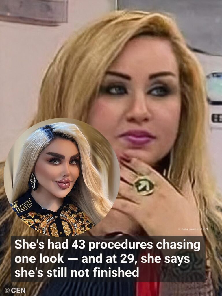 Iraqi TV Personality Undergoes 43 Procedures To Reshape Her Appearance Into A Living Doll